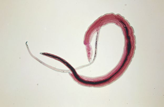 Schistosoma-haematobium